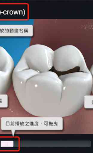 E-Yayi Dental Consult (zh-tw) 4