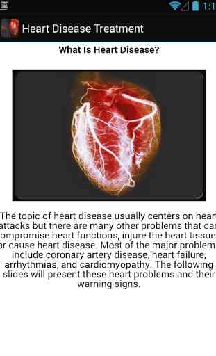 Heart Disease Treatment 2