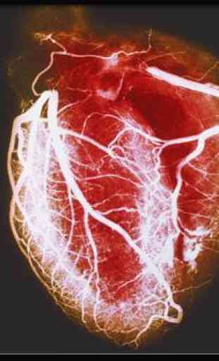 Heart Disease Treatment 3