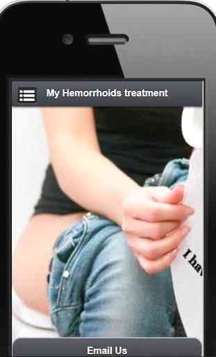 My Hemorrhoids Treatment 1