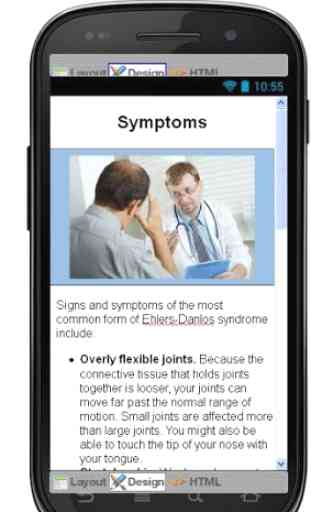 Ehlers Danlos Syndrome Disease 3