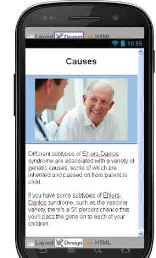 Ehlers Danlos Syndrome Disease 4