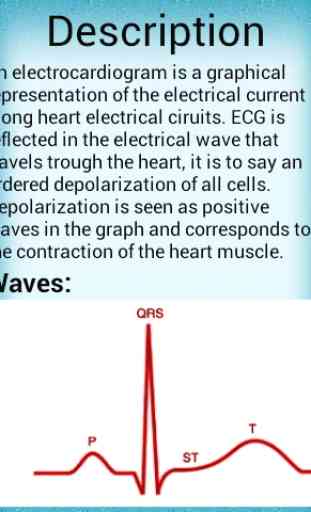 Electrocardiogram 2
