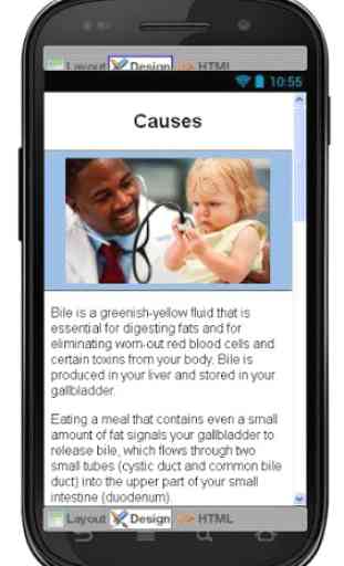 Bile Reflux Disease & Symptoms 4