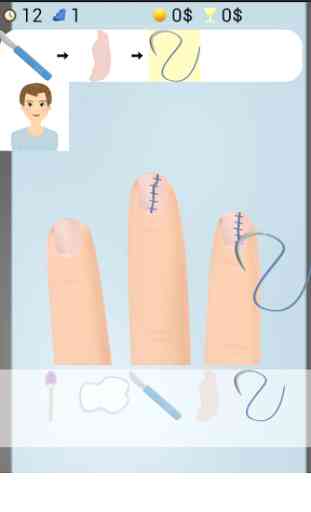 Nail Surgery Games 2