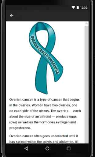 Ovarian Cancer 3