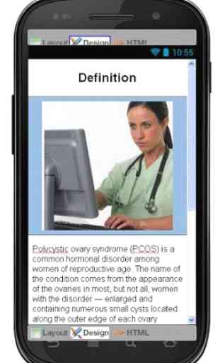 PCOS Disease & Symptoms 2