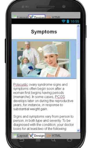 PCOS Disease & Symptoms 3