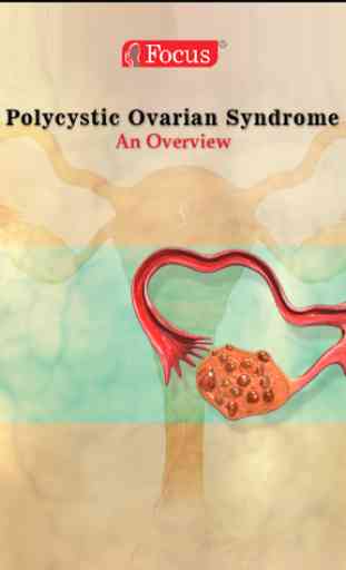 Polycystic Ovarian Syndrome 1