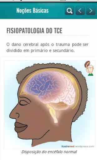 Traumatic Brain Injury (TBI) 2