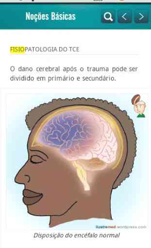 Traumatic Brain Injury (TBI) 4