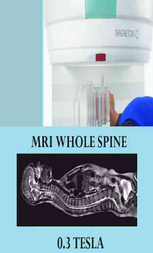 MRI POSITIONING WHOLE SPINE 1