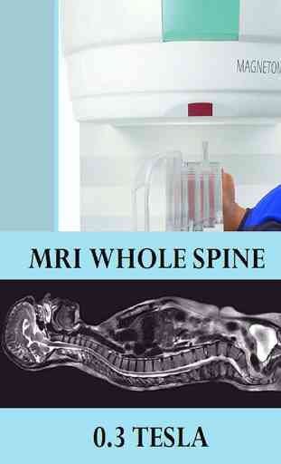 MRI POSITIONING WHOLE SPINE 2