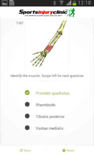 Human Muscles Quiz 3