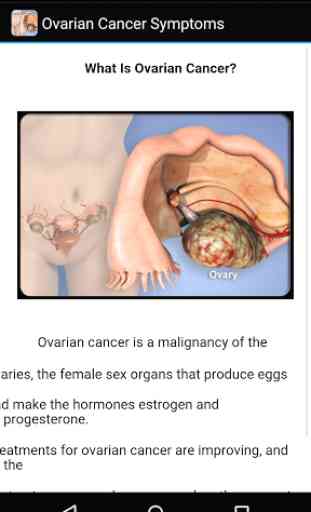 Ovarian Cancer Symptoms 3