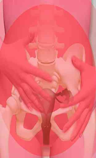 Ovarian Cancer Symptoms 1