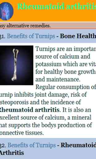 Cure for Rheumatoid Arthritis 3