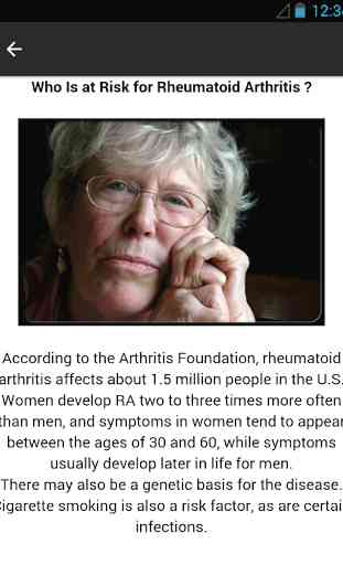 Rheumatoid Arthritis 3