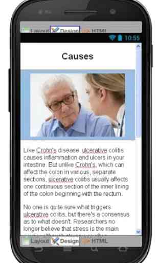 Ulcerative Colitis Information 4