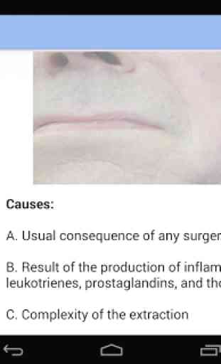 Oral Surgery Complications 4