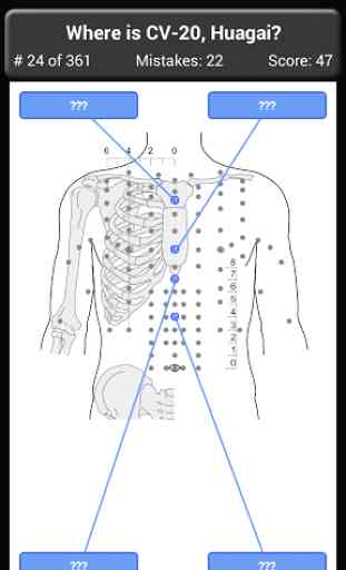 Acupuncture Points Body Quiz 2