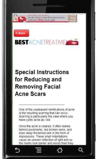 Best Acne Treatment 4