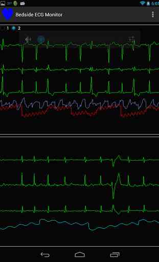 Bedside ECG Monitor 1