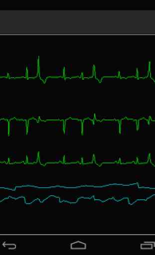 Bedside ECG Monitor 3