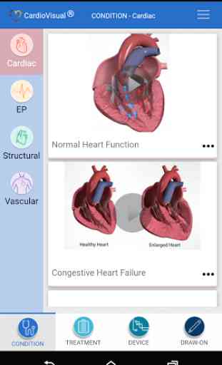 CardioVisual 1