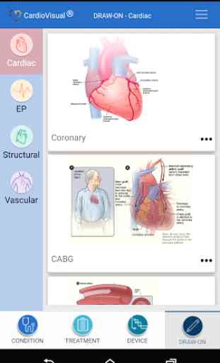 CardioVisual 4