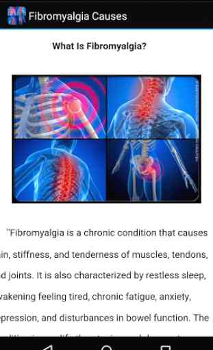 Fibromyalgia Causes 3