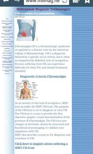 Fibromyalgia Visual Proof 2