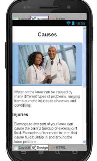 Water On The Knee Information 4