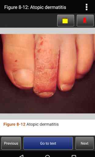 Color Atlas of Ped Dermatology 4