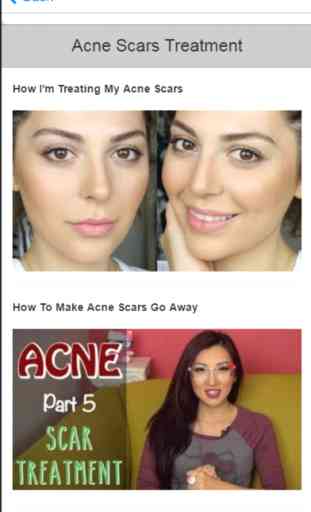 Acne Treatment - Learn How to Treat Acne Fast and Naturally 4