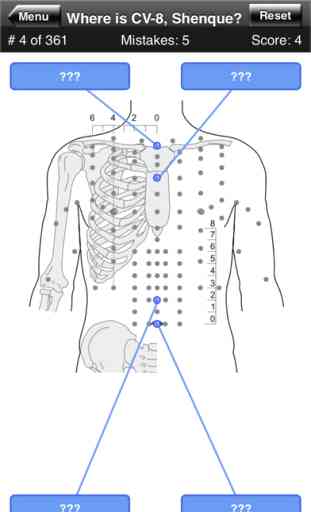Acupuncture Points Body Quiz 2