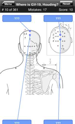 Acupuncture Points Body Quiz 4