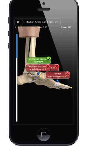 Ankle & Foot Pro III - iPhone Edition 3