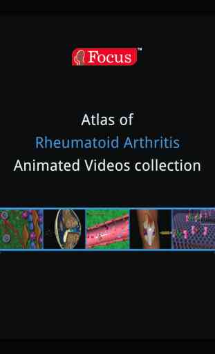 Atlas of Rheumatoid Arthritis 1