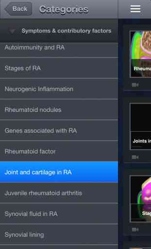 Atlas of Rheumatoid Arthritis 2