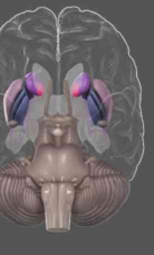 3D Brain 2