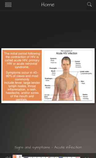 HIV-AIDS Info 3