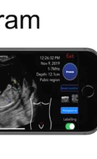 Scanbooster Ultrasound Sim 4