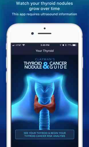 Thyroid Nodule & Cancer Guide 1