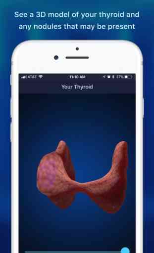 Thyroid Nodule & Cancer Guide 2