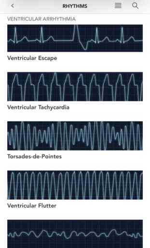 Instant ECG: An Electrocardiogram Rhythms Guide 3
