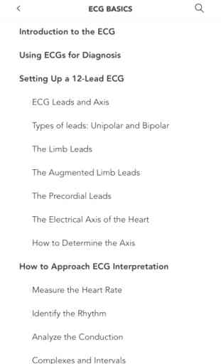 Instant ECG: An Electrocardiogram Rhythms Guide 4