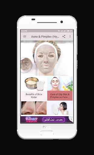 Acne & Pimples (Home Care) 2