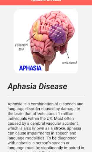 Aphasia Disease 3