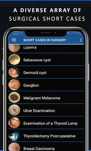 Short Cases in Surgery 3
